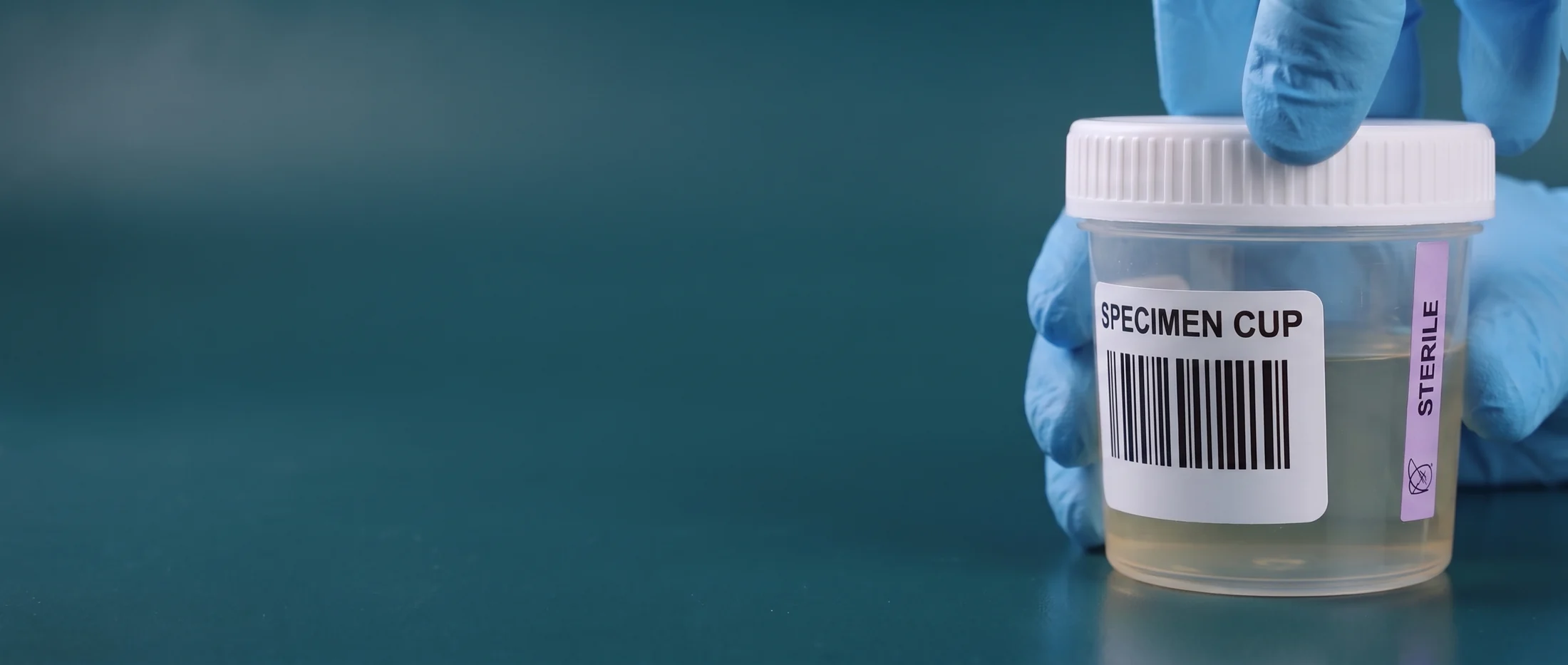 Gloved hands hold a sealed urine specimen cup labeled SPECIMEN CUP with a barcode and a purple tamper seal.